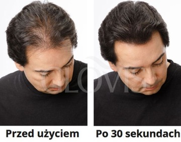 Włókna GLOVIS 25g Mikrowłókna Eko Saszetka Najwyższa Jakość Gęste Włosy