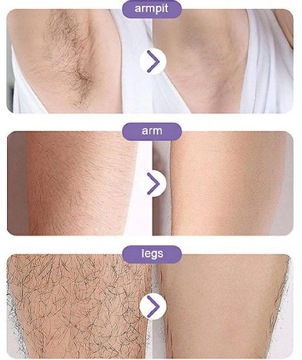 DEPILATOR BEZBOLESNY KRYSZTAŁOWY EPILATOR DO USUWANIA WŁOSÓW DEPILACJI