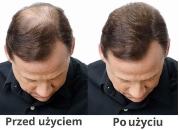 Sevich - Kosmetyk zagęszczający włosy saszetka