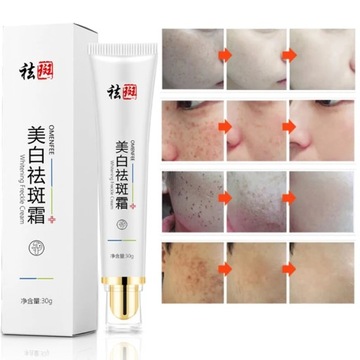 Skuteczny krem wybielający piegi usuń Melasma trądzik punktowy Pigment mela