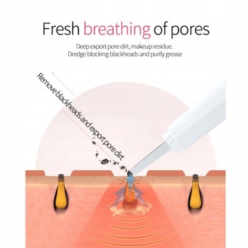 Ультразвуковой скруббер для кожи, глубокая очистка кожи