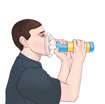 Портативное модернизированное устройство против удушья, аварийное всасывание, спасающее жизнь