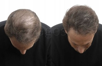 KAGOSHI Hair Fibers 28 г Загуститель для волос Качество микрофибры