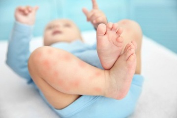 Масло от комаров и комаров.Натуральное, безопасное для детей и младенцев.