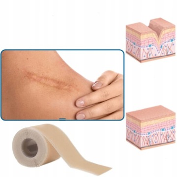 2X СИЛИКОНОВЫЕ ЗАПЛАТЫ ДЛЯ ШРАВОВ ЭФФЕКТИВНОЕ УДАЛЕНИЕ ПОСЛЕОПЕРАЦИОННЫХ ШРАВОВ