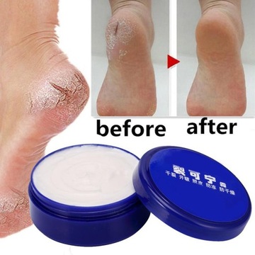 55 г крем от трещин для рук и ног против сухих потрескавшихся мест