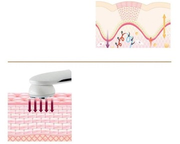 Ультразвуковой косметический массажер для лица 5в1