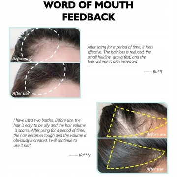 Новое масло для восстановления роста волос Эссенция эфирных масел