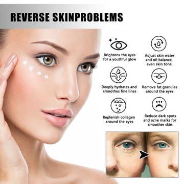 Крем для глаз, удаляющий морщины, уменьшает темные круги под глазами