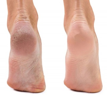 УВЛАЖНЯЮЩИЕ ГЕЛЕВЫЕ НОСКИ ДЛЯ ДОМАШНЕГО СПА