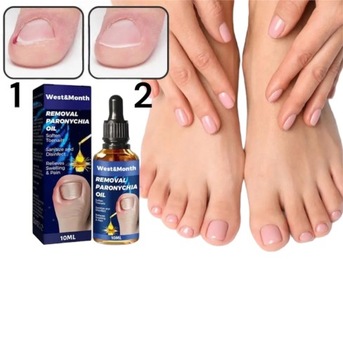 ЖИДКОСТЬ ДЛЯ ВРАСТАНИЯ НОГТЕЙ ОТ БОЛИ В НОГТЯХ