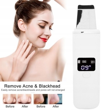 Ультразвуковой пилинг кожи лица