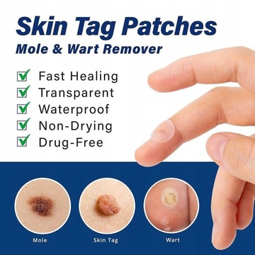 72 шт. ПАТЧИ ДЛЯ УДАЛЕНИЯ БОРОРОДОК