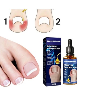 ЖИДКОСТЬ ДЛЯ ВРАСТАНИЯ НОГТЕЙ ОТ БОЛИ В НОГТЯХ