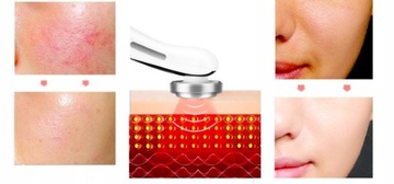 БЕЗИНГОЛЬНАЯ МЕЗОТЕРАПИЯ EMS МАССАЖЕР ДЛЯ ЛИЦА ЛИФТИНГ В ПОДАРОК ​​5 В 1 БЕСПЛАТНО