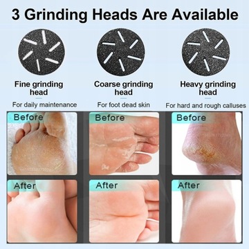Электрический прибор для удаления мозолей на ногах Electric Foo