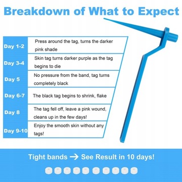 Tag skóry Zabij opaska do usuwania brodawek
