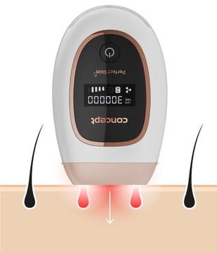Эпилятор Concept IPL PERFECT SKIN 300 000 импульсов