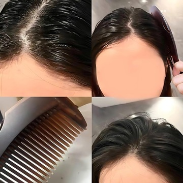 РАСЧЕСКА ДЛЯ БОРЬБЫ С ПЕРХОТЬЮ ПРОФЕССИОНАЛЬНАЯ РАСЧЕСКА ДЛЯ БОРЬБЫ С ПЕРХОТЬЮ