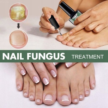 Nail Repair Essence Грибковая сыворотка 10 мл