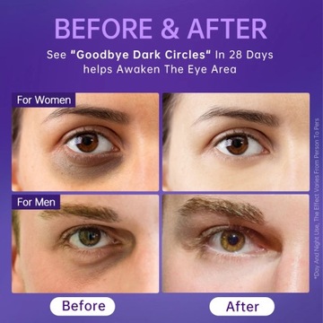 Крем для глаз от мешков под глазами, уход за кожей против темных кругов