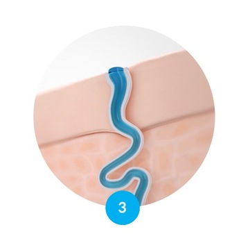 PERSPIREX Лосьон для ног АНТИПЕРСПИРАНТ для НОГ против потливости 100мл жидкость