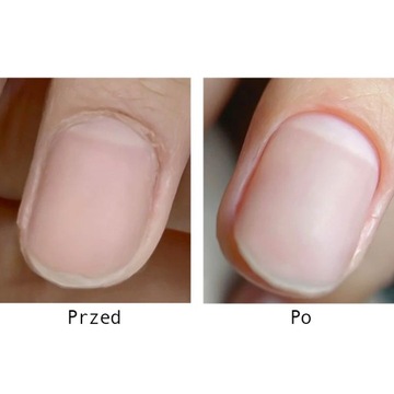 Radełko Do Paznokci Usuwania Skórek Kopytko Dłutko Pusher