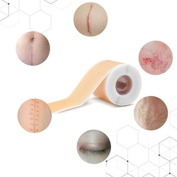 2X СИЛИКОНОВЫЕ ЗАПЛАТЫ ДЛЯ ШРАВОВ ЭФФЕКТИВНОЕ УДАЛЕНИЕ ПОСЛЕОПЕРАЦИОННЫХ ШРАВОВ