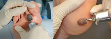 10x kapturek ścierny 13mm #240 korund pedicure