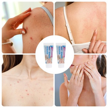 2шт мазь для удаления бородавок китайские травяные бородавки