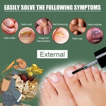 Nail Repair Essence Грибковая сыворотка 10 мл