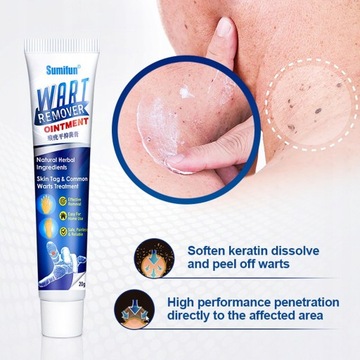 Wart Removal Ointment Instant Blemish Removal Gel