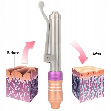 Ручка для инъекций гиалуроновой кислоты 7 см yi6eg