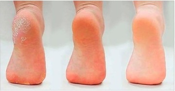 Соль Аркада Подологическая 500г