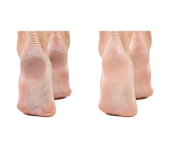 ПЯТОЧНЫЙ КРЫС из наностекла РОЗОВАЯ ПЕМЗА