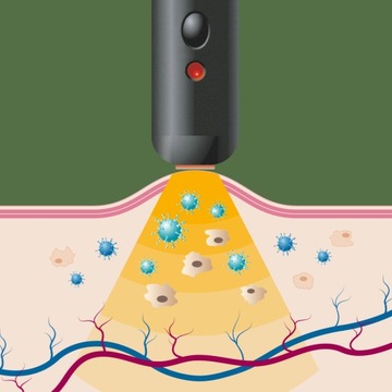 HERPOTHERM szminka lecząca opryszczkę na ustach