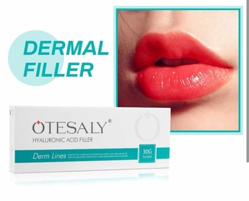 KWAS HIALURONOWY USIECIOWANY 25MG OTESALY 1ML DERM