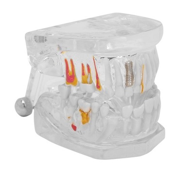 MODEL ZĘBÓW DENTYSTYCZNYCH DLA DOROSŁYCH