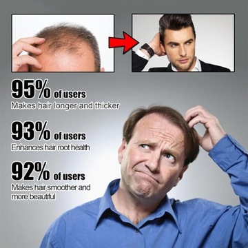 Спрей для роста волос, Натуральное восстановление роста волос, Сыворотка