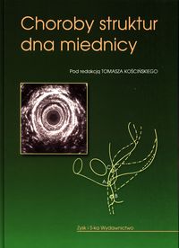 Choroby struktur dna miednicy Kościński Zysk