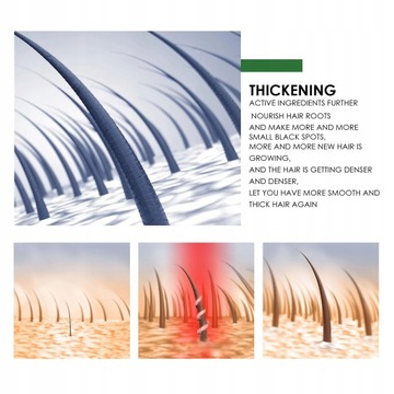 Эффект розмарина ускоряет рост волос