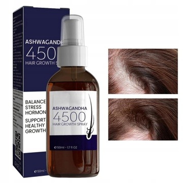 Спрей для роста волос, которые быстро растут против выпадения