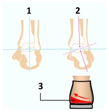 Поддержка обуви Инвазии Органические цены