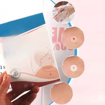 Plastry na wypryski punktowe, białe