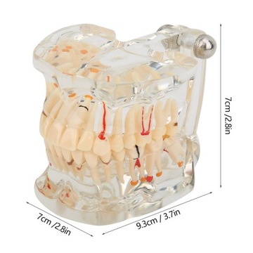 СТОМАТОЛОГИЧЕСКАЯ МОДЕЛЬ ЧЕЛЮСТИ СТОМАТОЛОГИЧЕСКАЯ СЛЭМИ