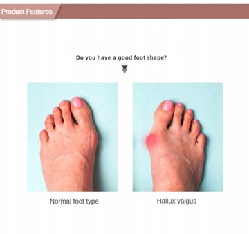 2 шт. = 1 пара, разделитель для ухода за ногами, защита пальцев