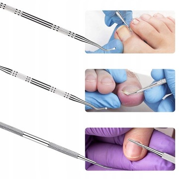 Набор долот Podiatry PROBE для врастания ногтей на ногах, двусторонний, 3 шт.