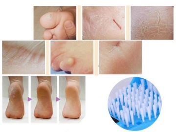 ЩЕТКА ДЛЯ ДУША EASY FEET ДЛЯ МЫТЬЯ НОГ
