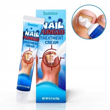 Sumifun Nail Fungus Cream Toenail Fungus Remover