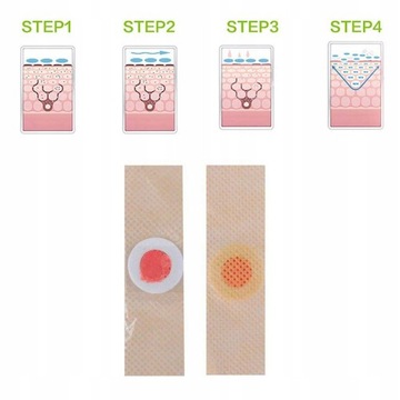 180 штук пластырей для удаления миомы